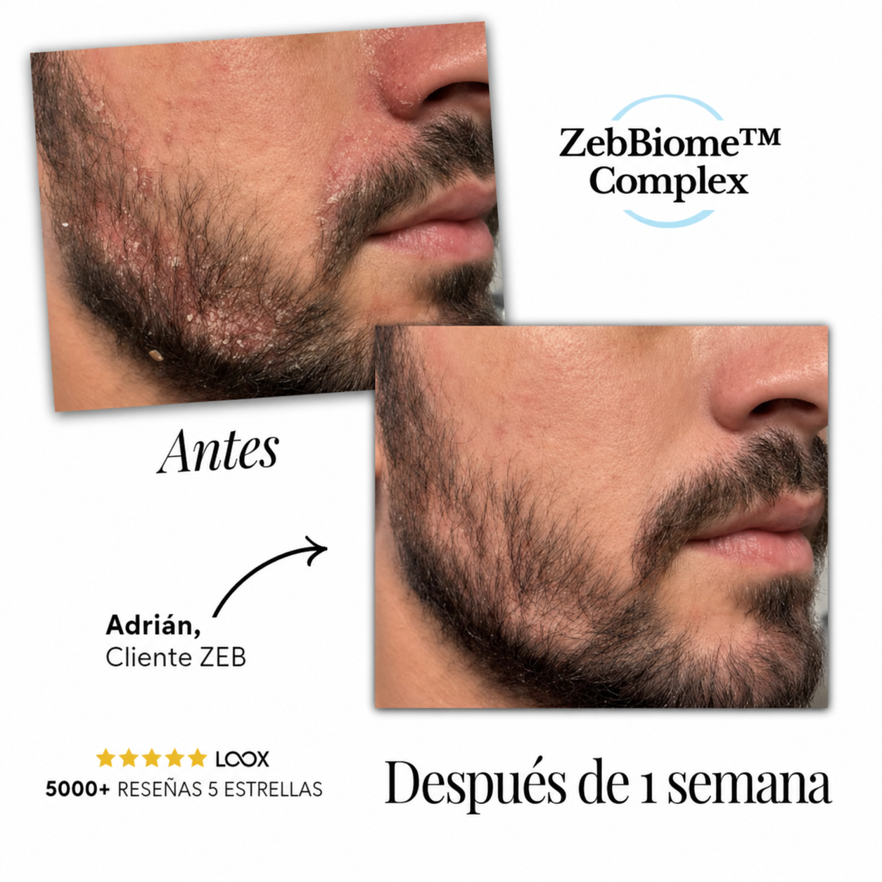Serum ANTI dermatitis Sarborreica